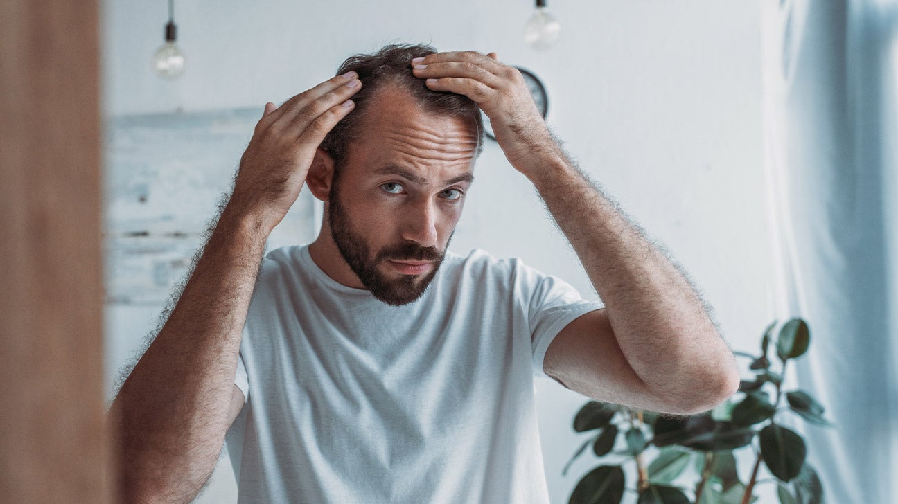 How to Manage Hair Loss as a Side Effect of IBD