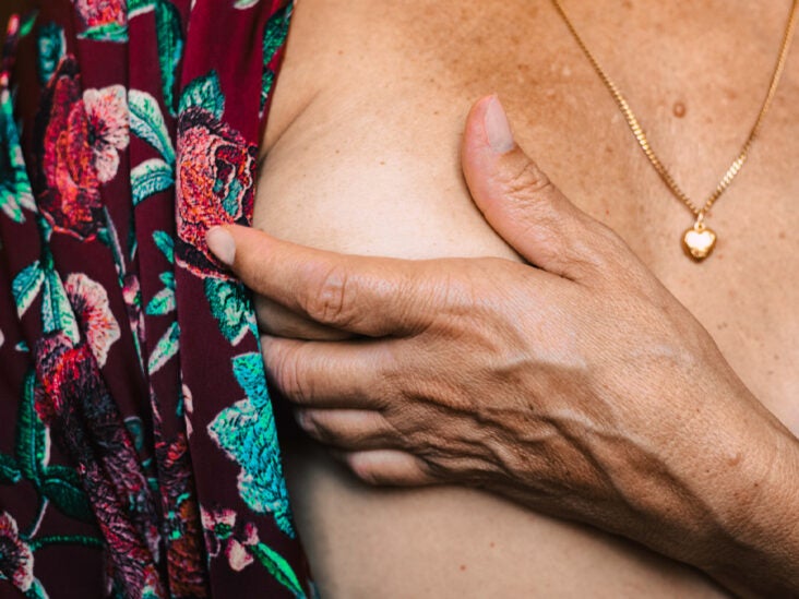 6 Overlooked Signs of Breast Cancer